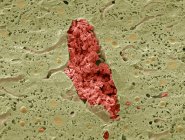 Цветной сканирующий электронный микрограф (СЭМ) секции через вену в печени, заполненную красными кровяными тельцами (эритроциты, красные ). — стоковое фото