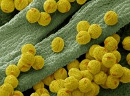 Pollen grains from a bellflower — Stock Photo