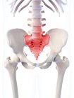 Focus of inflammation localized in sacrum — Stock Photo