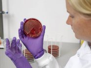 Bacterial contamination tests — Stock Photo