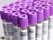 Labelled vacutainer tubes containing blood samples, close-up. — Stock Photo