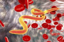 Microfilaria vermes no sangue — Fotografia de Stock