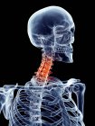 Dor no pescoço localizada em vértebras cervicais — Fotografia de Stock