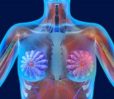 Злокачественная опухоль в женской груди — стоковое фото