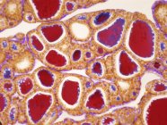 Ghiandola tiroidea che mostra i follicoli — Foto stock