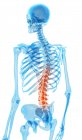 Dolore localizzato nella sezione lombare della colonna vertebrale — Foto stock