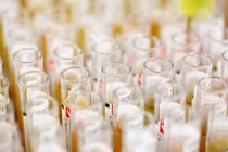 Labelled test tubes with blood samples. — Stock Photo