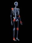 Hombro y cintura articulaciones dolor - foto de stock