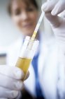 Close-up of multiple test stick being placed into urine sample tube by female doctor. — Stock Photo