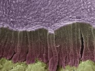 Micrografía electrónica de barrido coloreado (SEM) de un conducto biliar fracturado . - foto de stock