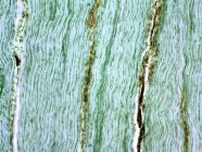 Tendine che mostrano le fibre parallele di collagene — Foto stock