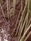 Волосяные валы, растущие из человеческой кожи — стоковое фото
