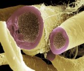 Волокна миелинизированного нерва — стоковое фото