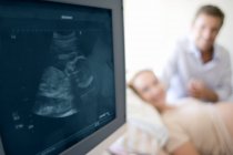 Expectant parents watching monitor displaying image of unborn baby. — Stock Photo