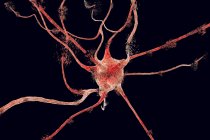 Apoptose das células neuronais — Fotografia de Stock