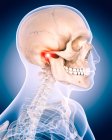 Focus of inflammation localized in jaw — Stock Photo