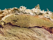 Micrografia eletrônica de varredura colorida (MEV) de uma seção através da pele saudável . — Fotografia de Stock