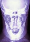 Estructura normal del cráneo de un adulto joven - foto de stock