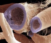Myelinated нервових волокон — стокове фото