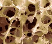 Tessuto osseo cancelloso — Foto stock