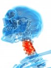 Dolor localizado en vértebras cervicales - foto de stock