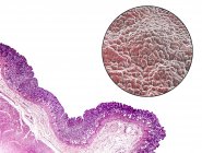 Micrografía ligera (abajo a la izquierda) e ilustración por computadora (arriba a la derecha) del revestimiento del estómago, conocida como la mucosa
. - foto de stock