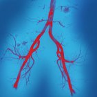 Coloured angiogram (blood vessel X-ray) of arteries in the pelvic region. — Stock Photo