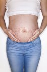 Mujer embarazada con erupción en la panza - foto de stock
