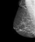Breast cancer screening — Stock Photo