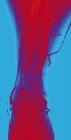 Нормальные вены ног, цветная ангиограмма - рентген кровеносных сосудов — стоковое фото