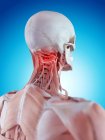 Douleur affectant les muscles et les vertèbres cervicales — Photo de stock