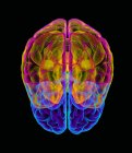 Anatomie cérébrale humaine — Photo de stock