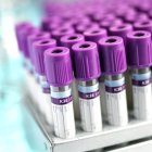 Blood sampling vacutainer tubes in rack, close-up. — Stock Photo