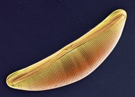 Fotosintética Navicula sp. diatomea - foto de stock