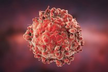 Krebsartige weiße Blutkörperchen bei Leukämie — Stockfoto