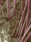 Волосяные валы, растущие из человеческой кожи — стоковое фото