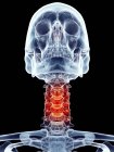 Nackenschmerzen in Halswirbeln lokalisiert — Stockfoto