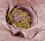 Бактерии в форме ода Tragelaphus — стоковое фото