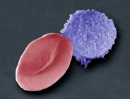 Micrografía electrónica de barrido de color (SEM) de un glóbulo rojo humano (eritrocitos, rojos) y un glóbulo blanco (leucocitos, azules) ). - foto de stock