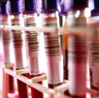 Primer plano de la rejilla de tubos de muestra con sangre para análisis . - foto de stock