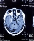 Mri scan (imagerie par résonance magnétique) de la tête humaine
. — Photo de stock