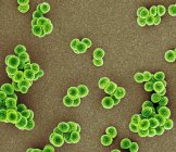 Staphylococcus aureus resistente a la meticilina — Stock Photo