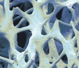 Tessuto osseo cancelloso — Foto stock