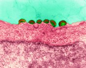 Vírus maduro e brotamento liberação do HIV — Fotografia de Stock