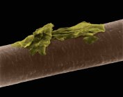 Человеческие волосы с перхоти, цветной сканирующий электронный микрограф (SEM ). — стоковое фото