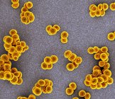 Staphylococcus aureus resistente a la meticilina — Stock Photo