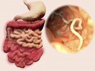 Инфекция ленточных червей человека, иллюстрация — стоковое фото