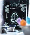 Brain scans displayed on a screen — Stock Photo