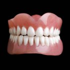 Модель людських зубів — стокове фото