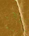Escherichia coli à la surface de la peau humaine — Photo de stock